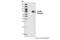 Endoglin antibody, 3290S, Cell Signaling Technology, Western Blot image 