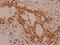 Kinase Suppressor Of Ras 1 antibody, A03285, Boster Biological Technology, Immunohistochemistry frozen image 