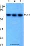 Gamma-Glutamyltransferase 5 antibody, A09783, Boster Biological Technology, Western Blot image 