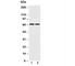 Solute Carrier Family 2 Member 12 antibody, R31288, NSJ Bioreagents, Western Blot image 