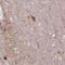 Growth Factor Receptor Bound Protein 7 antibody, HPA057084, Atlas Antibodies, Immunohistochemistry frozen image 