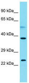 WD Repeat And Coiled Coil Containing antibody, TA330769, Origene, Western Blot image 