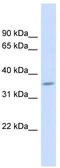 Calcium Homeostasis Modulator Family Member 6 antibody, TA336125, Origene, Western Blot image 