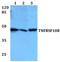 TNF Receptor Superfamily Member 10b antibody, GTX66750, GeneTex, Western Blot image 