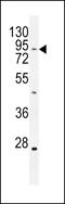 TBC1 Domain Family Member 14 antibody, LS-C161726, Lifespan Biosciences, Western Blot image 