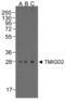 Transmembrane And Immunoglobulin Domain Containing 2 antibody, RF16121, ProSci, Western Blot image 