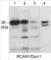 Regulator Of Calcineurin 1 antibody, RP3941, ECM Biosciences, Western Blot image 
