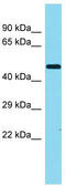 Transmembrane Protein 246 antibody, TA333616, Origene, Western Blot image 