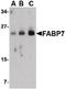 Fatty Acid Binding Protein 7 antibody, LS-C34713, Lifespan Biosciences, Western Blot image 