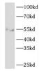 EDIL3 antibody, FNab02636, FineTest, Western Blot image 
