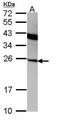 Interferon Alpha 2 antibody, PA5-21926, Invitrogen Antibodies, Western Blot image 