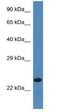 Signal Sequence Receptor Subunit 2 antibody, NBP1-74209, Novus Biologicals, Western Blot image 