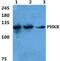 Phosphorylase Kinase Regulatory Subunit Beta antibody, PA5-37015, Invitrogen Antibodies, Western Blot image 