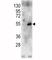 Ribosomal Protein S6 Kinase B2 antibody, F50953-0.4ML, NSJ Bioreagents, Western Blot image 