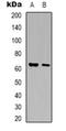 Arylsulfatase G antibody, orb318995, Biorbyt, Western Blot image 
