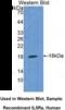 Interleukin-5 receptor subunit alpha antibody, MBS2004743, MyBioSource, Western Blot image 