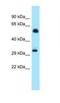 Inositol Hexakisphosphate Kinase 1 antibody, NBP1-98398, Novus Biologicals, Western Blot image 