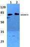 ADAM Metallopeptidase Domain 10 antibody, A00566-4, Boster Biological Technology, Western Blot image 