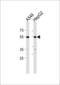 Aldehyde Dehydrogenase 2 Family Member antibody, 57-651, ProSci, Western Blot image 