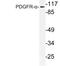 Platelet Derived Growth Factor Receptor Alpha antibody, LS-C177791, Lifespan Biosciences, Western Blot image 
