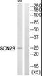 Sodium Voltage-Gated Channel Beta Subunit 2 antibody, PA5-39464, Invitrogen Antibodies, Western Blot image 