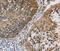 Carbonyl Reductase 1 antibody, MBS2522521, MyBioSource, Immunohistochemistry paraffin image 