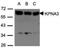 Karyopherin Subunit Alpha 3 antibody, NBP1-31031, Novus Biologicals, Western Blot image 