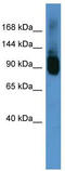 ATP Binding Cassette Subfamily F Member 1 antibody, TA332251, Origene, Western Blot image 