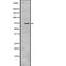 Kinesin Family Member C1 antibody, PA5-67899, Invitrogen Antibodies, Western Blot image 