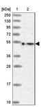 Solute Carrier Family 15 Member 5 antibody, NBP2-14511, Novus Biologicals, Western Blot image 