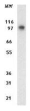 Eukaryotic translation initiation factor 4 gamma 2 antibody, GTX11929, GeneTex, Western Blot image 