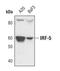 Interferon Regulatory Factor 5 antibody, PA5-17255, Invitrogen Antibodies, Western Blot image 