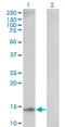 Ubiquitin Conjugating Enzyme E2 D1 antibody, LS-B9029, Lifespan Biosciences, Western Blot image 