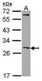 Glutathione S-Transferase Mu 1 antibody, GTX100298, GeneTex, Western Blot image 