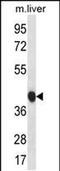 BEN Domain Containing 7 antibody, PA5-48448, Invitrogen Antibodies, Western Blot image 