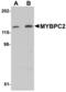 NADH:Ubiquinone Oxidoreductase Subunit B9 antibody, orb94371, Biorbyt, Western Blot image 