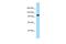 PPFIA Binding Protein 2 antibody, A12442, Boster Biological Technology, Western Blot image 