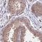 Hydroxymethylbilane Synthase antibody, NBP2-33600, Novus Biologicals, Immunohistochemistry frozen image 