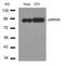 Ribosomal Protein S6 Kinase A1 antibody, GTX50479, GeneTex, Western Blot image 