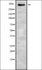 Zinc Finger Homeobox 4 antibody, orb336202, Biorbyt, Western Blot image 