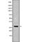 Centromere Protein H antibody, abx149224, Abbexa, Western Blot image 