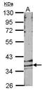 G Protein-Coupled Receptor 146 antibody, PA5-34621, Invitrogen Antibodies, Western Blot image 
