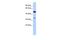 Phosphoinositide-3-Kinase Interacting Protein 1 antibody, PA5-43519, Invitrogen Antibodies, Western Blot image 