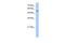 UDP Glycosyltransferase Family 3 Member A2 antibody, GTX46127, GeneTex, Western Blot image 