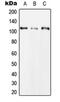 Chloride Voltage-Gated Channel 1 antibody, orb215454, Biorbyt, Western Blot image 