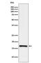 LIM Domain Only 4 antibody, M06555, Boster Biological Technology, Western Blot image 