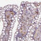 CD3g Molecule antibody, HPA038494, Atlas Antibodies, Immunohistochemistry frozen image 
