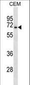 Acid Sensing Ion Channel Subunit 3 antibody, LS-C160993, Lifespan Biosciences, Western Blot image 