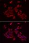 Retinoic acid receptor responder protein 2 antibody, LS-C335708, Lifespan Biosciences, Immunofluorescence image 
