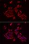 Retinoic Acid Receptor Responder 2 antibody, LS-C335708, Lifespan Biosciences, Immunofluorescence image 